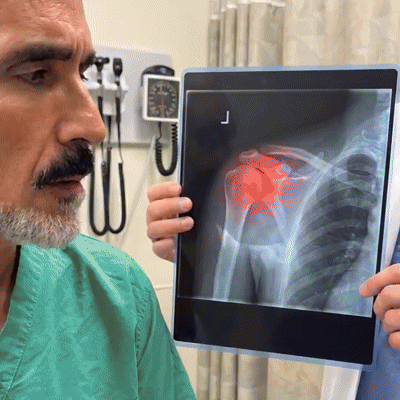 למה ShoulderCare מרגיש שונה - ולמה זה מחזיק
